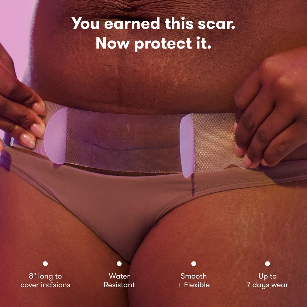 Frida Mom C Section Silicone Scar Patches – Fasha silikoni për shenjat e operacionit cezarian.
