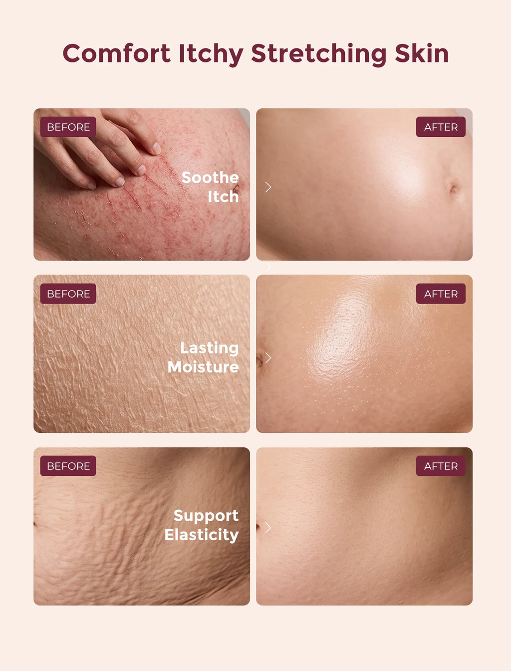 Momcozy ProCollagen Belly Firming Moisturizer- Krem Hidratues dhe Firmues për Barkun me ProKollagjen